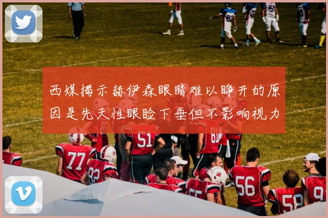 西媒揭示赫伊森眼睛难以睁开的原因是先天性眼睑下垂但不影响视力
